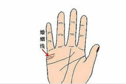 手上痣相圖解大全?手上痣相圖解10大福痣